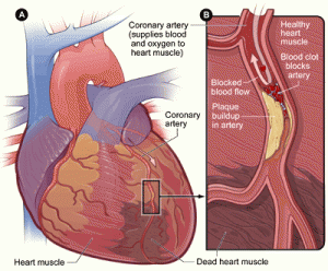 heart_coronary_artery